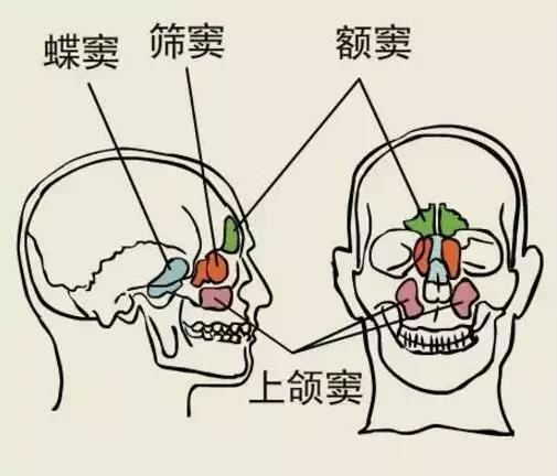 鼻窦是人颅骨鼻腔周围的一些含气的空腔,包括额窦,上颌窦,筛窦,蝶窦.